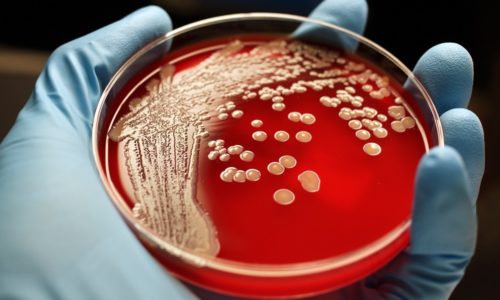 Бактериологический посев используют в том случае, если есть подозрение на инфекцию мочеполовой системы