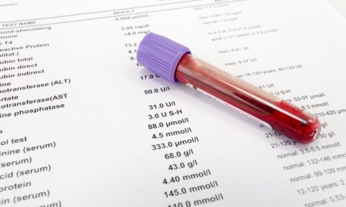 Результат анализа крови чаще всего без специфических изменений. Он проводится для дифференциальной диагностики цистита с пиелонефритом (воспалением почек)