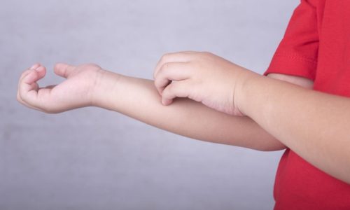 Необходимо проявлять осторожность в применении фиточая для детей, склонных к аллергии