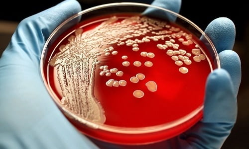 Чтобы выявить тип микроорганизмов, которые вызвали цистит, проводят бактериальный посев мочи