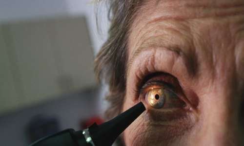 При выполнении парабульбарных инъекций роговица глаза может окрашиваться в темный цвет