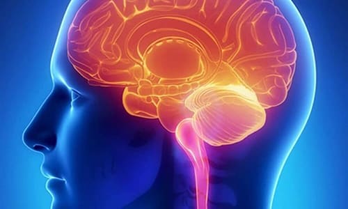 При ишемическом инсульте препарат способствует активизации мозгового кровообращения, уменьшает площадь некротического поражения тканей мозга