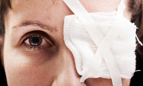 Раствор Солкосерила для инъекций показан для лечения травм роговицы глаза