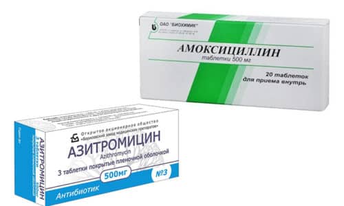 Амоксициллин или Азитромицин - группа препаратов, способных подавлять рост и размножение патогенных микроорганизмов или уничтожать их