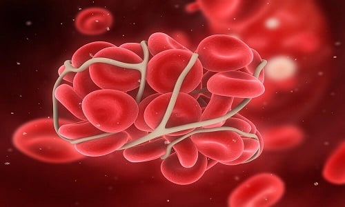 Натуральный препарат влияет на свертываемость крови