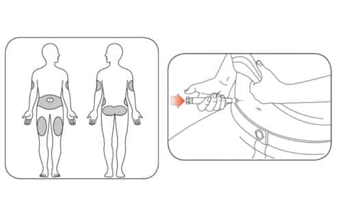 Хумулин НПХ вводится под кожу, следуя технике, которую рекомендовал лечащий врач, большим пальцем твердо нажать на кнопку введения препарата