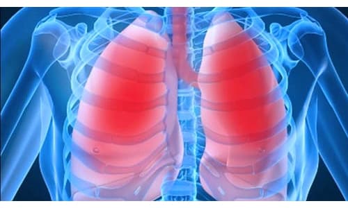 Препарат амоксил 250 назначается при инфекциях органов дыхания